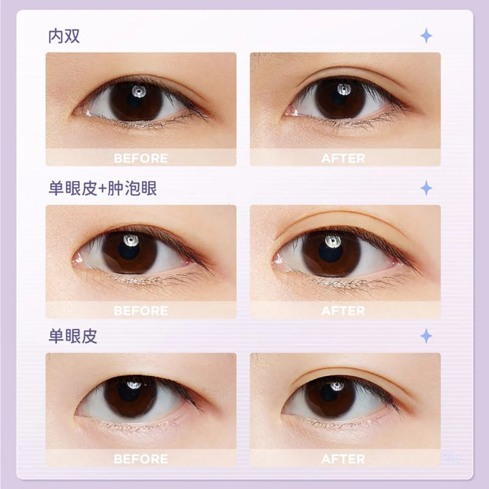 Everbab Traceless Eyelid Stickers - S Shape, 400 Pieces - Image 5