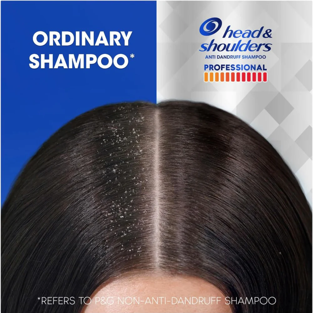 Head & Shoulders Professional Severe Dandruff Advanced Oil Control Shampoo 300ml - Image 2