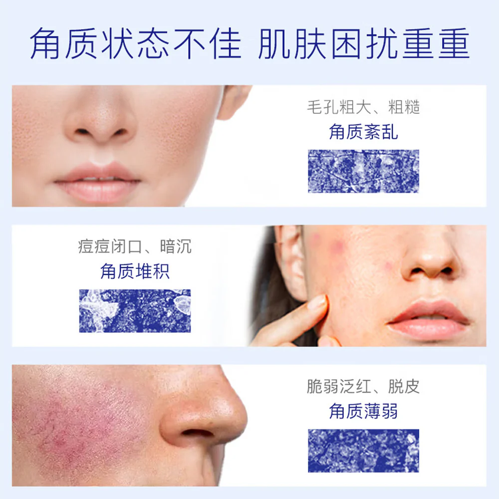 Takami Skinpeel Essence Exfoliating Serum 30ml - Image 5
